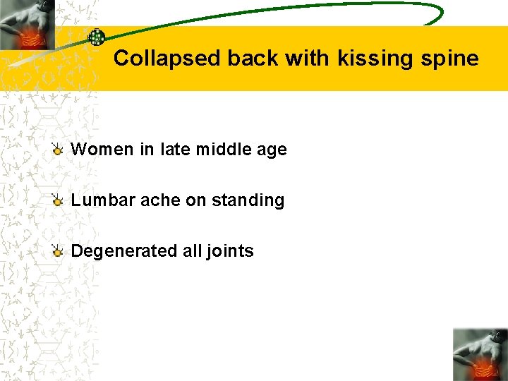 Collapsed back with kissing spine Women in late middle age Lumbar ache on standing