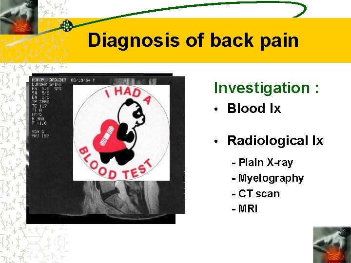 Diagnosis of back pain Investigation : • Blood Ix • Radiological Ix - Plain