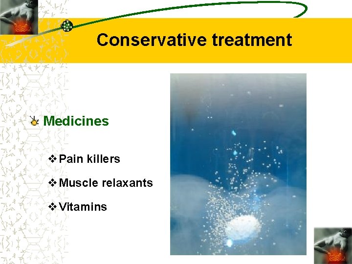 Conservative treatment Medicines v. Pain killers v. Muscle relaxants v. Vitamins 