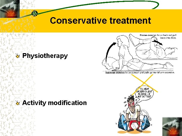 Conservative treatment Physiotherapy Activity modification 