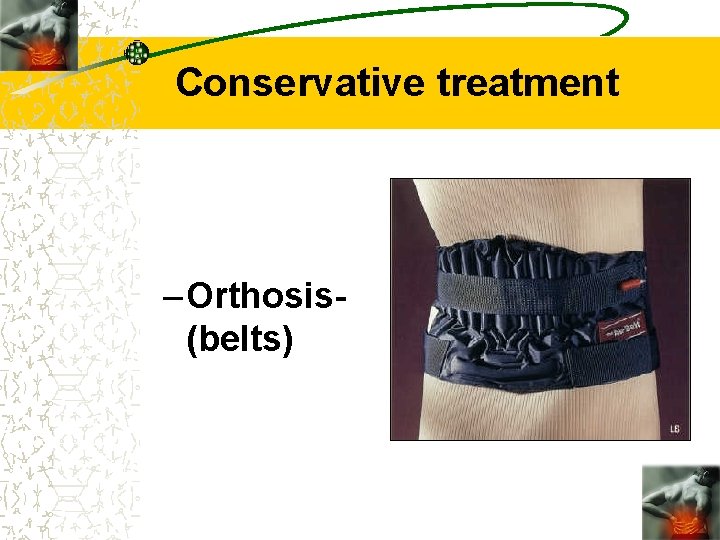 Conservative treatment – Orthosis(belts) 