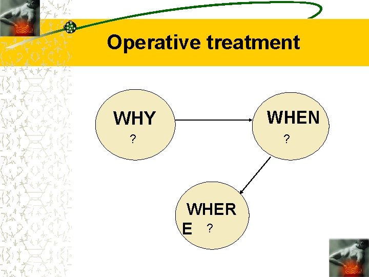 Operative treatment WHEN WHY ? ? WHER E ? Operative treatment WHEN WHY ? ? WHER E ?