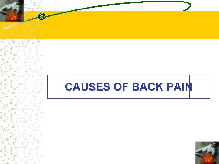 CAUSES OF BACK PAIN 