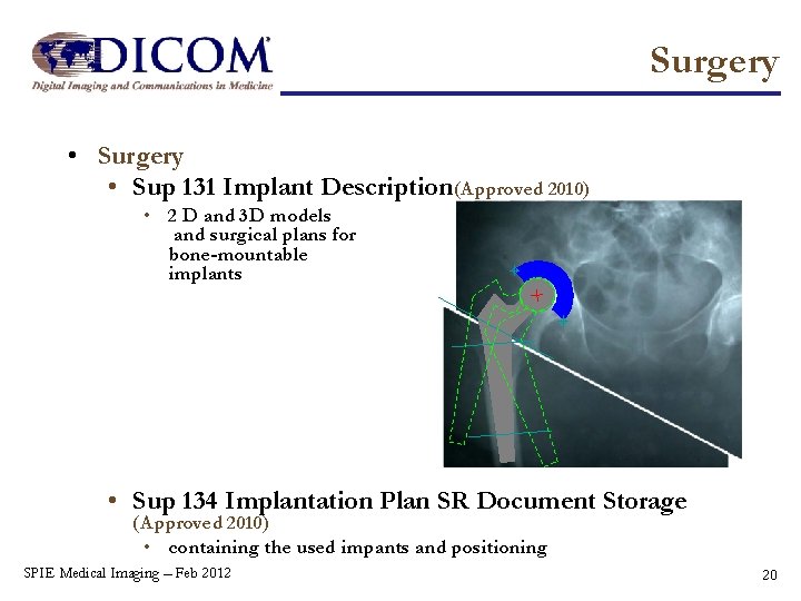 Surgery • Sup 131 Implant Description (Approved 2010) • 2 D and 3 D