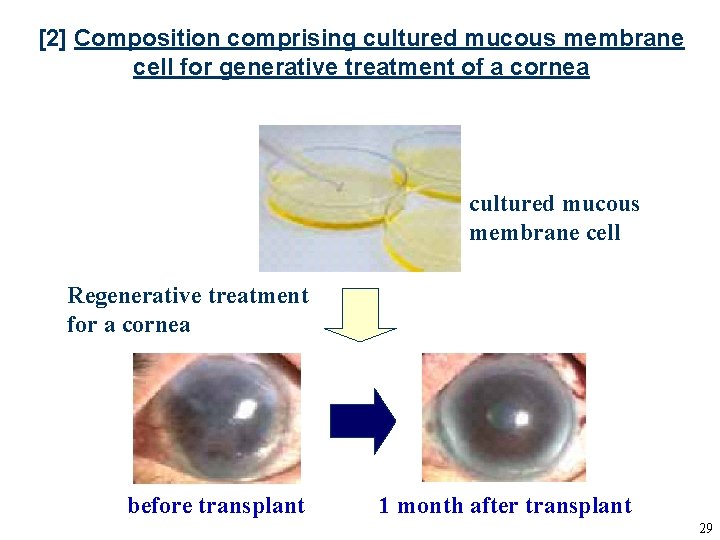 [2] Composition comprising cultured mucous membrane cell for generative treatment of a cornea cultured