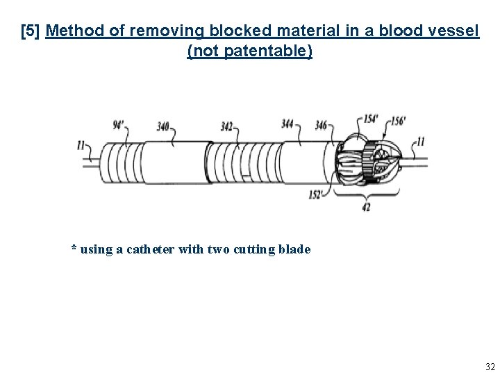 [5] Method of removing blocked material in a blood vessel (not patentable) * using