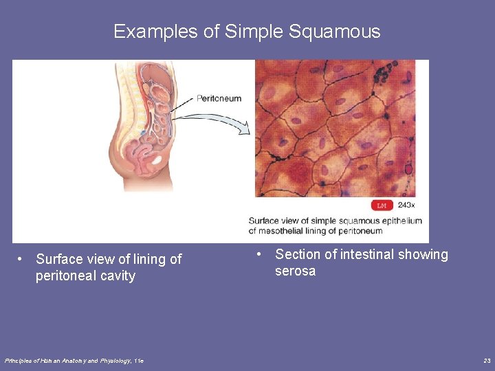 Examples of Simple Squamous • Surface view of lining of peritoneal cavity Principles of