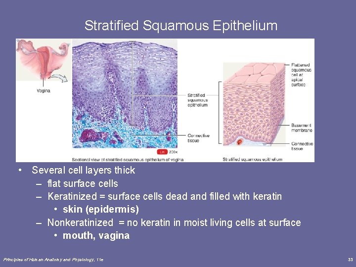 Stratified Squamous Epithelium • Several cell layers thick – flat surface cells – Keratinized