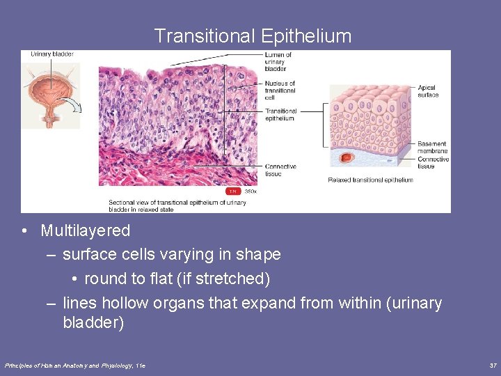Transitional Epithelium • Multilayered – surface cells varying in shape • round to flat