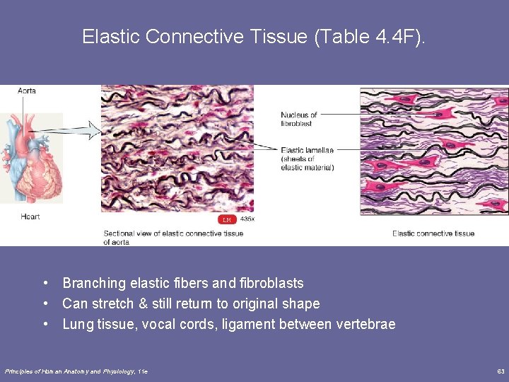 Elastic Connective Tissue (Table 4. 4 F). • Branching elastic fibers and fibroblasts •