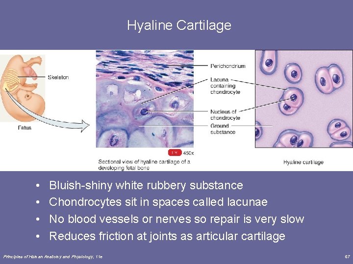 Hyaline Cartilage • • Bluish-shiny white rubbery substance Chondrocytes sit in spaces called lacunae