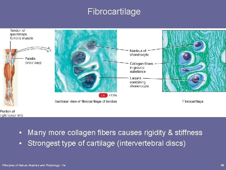 Fibrocartilage • Many more collagen fibers causes rigidity & stiffness • Strongest type of
