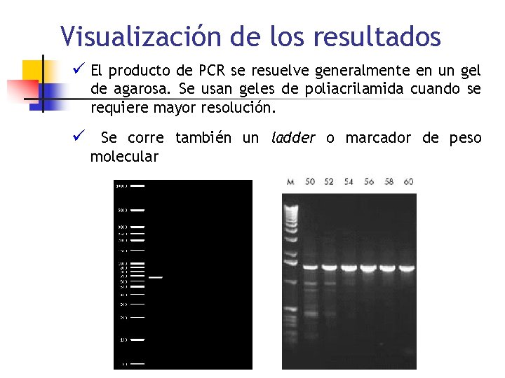 Visualización de los resultados ü El producto de PCR se resuelve generalmente en un