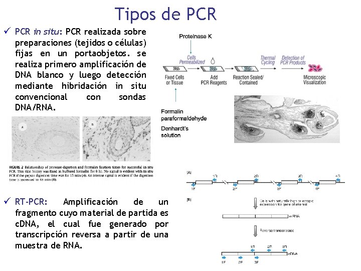 Tipos de PCR ü PCR in situ: PCR realizada sobre preparaciones (tejidos o células)