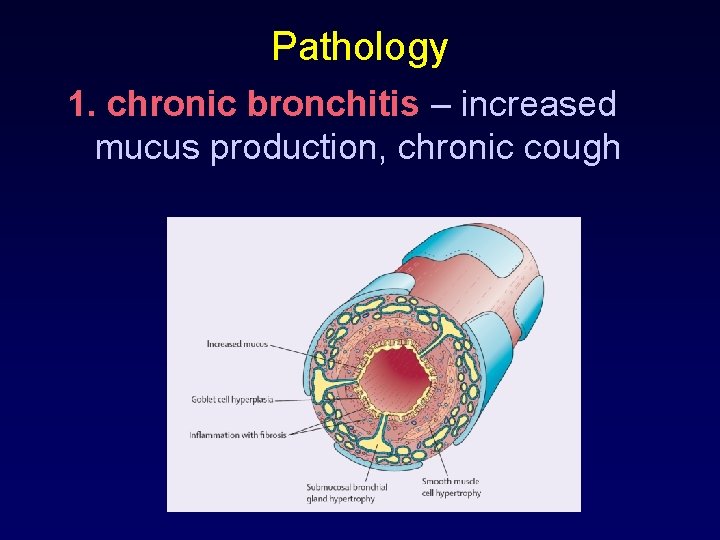 Pathology 1. chronic bronchitis – increased mucus production, chronic cough 
