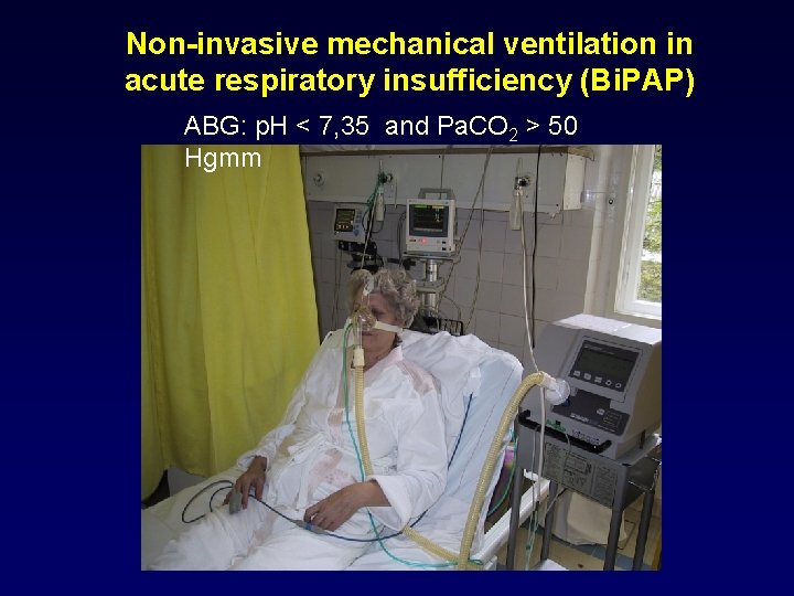 Non-invasive mechanical ventilation in acute respiratory insufficiency (Bi. PAP) ABG: p. H < 7,