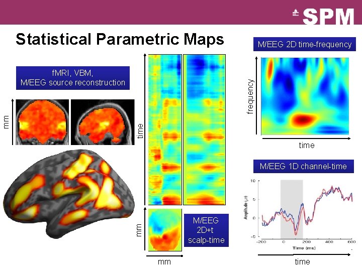 Statistical Parametric Maps frequency time mm f. MRI, VBM, M/EEG source reconstruction M/EEG 2