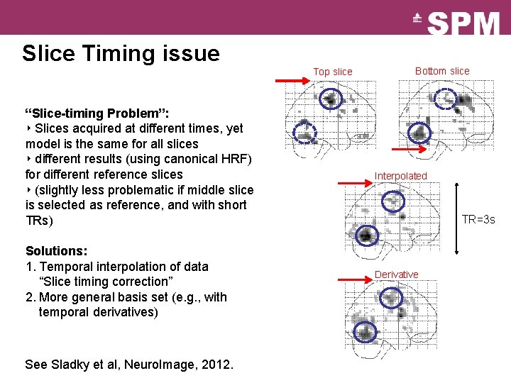 Slice Timing issue Top slice “Slice-timing Problem”: ‣ Slices acquired at different times, yet