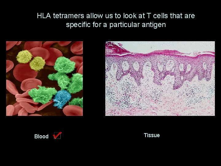 HLA tetramers allow us to look at T cells that are specific for a