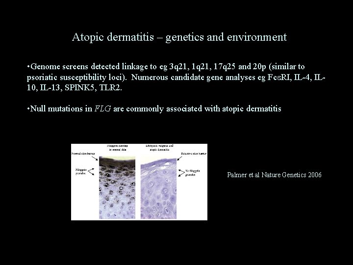 Atopic dermatitis – genetics and environment • Genome screens detected linkage to eg 3