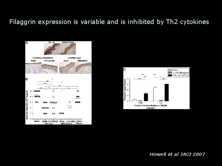 Filaggrin expression is variable and is inhibited by Th 2 cytokines Howell et al