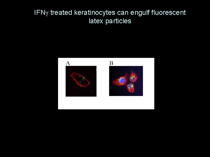 IFNg treated keratinocytes can engulf fluorescent latex particles 