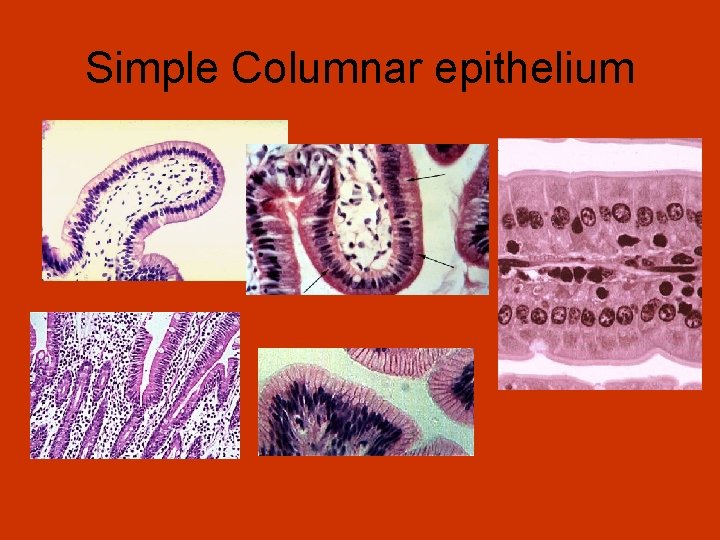 Simple Columnar epithelium 