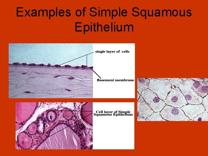 Examples of Simple Squamous Epithelium 