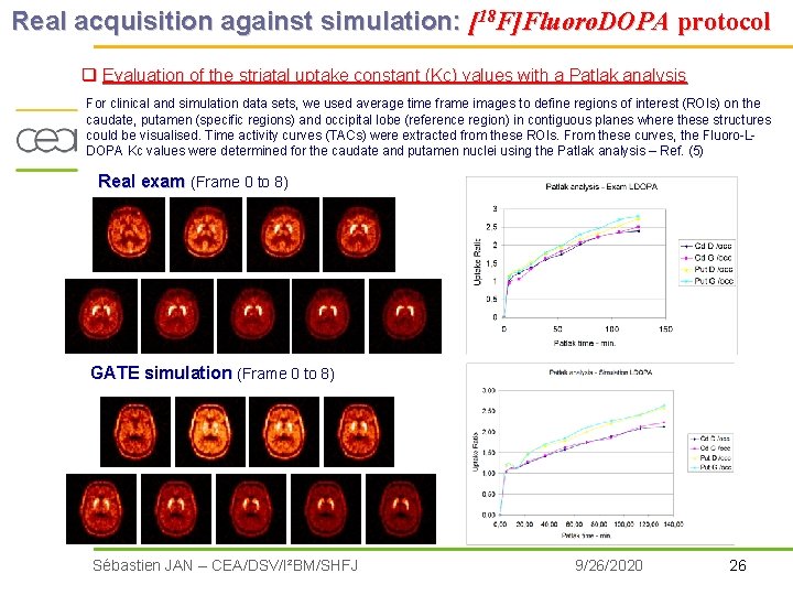Real acquisition against simulation: [18 F]Fluoro. DOPA protocol q Evaluation of the striatal uptake