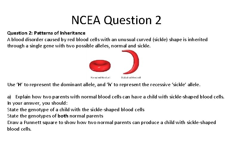 NCEA Question 2: Patterns of Inheritance A blood disorder caused by red blood cells