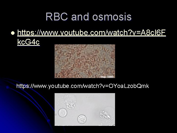 RBC and osmosis l https: //www. youtube. com/watch? v=A 8 c. I 6 F
