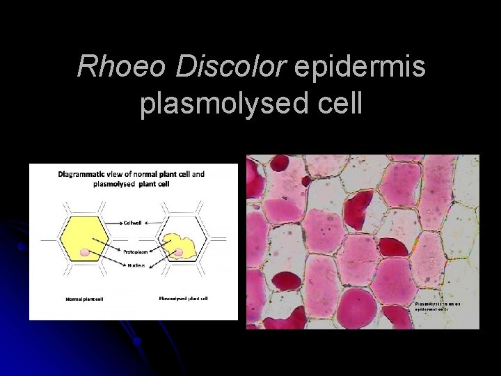 Rhoeo Discolor epidermis plasmolysed cell 