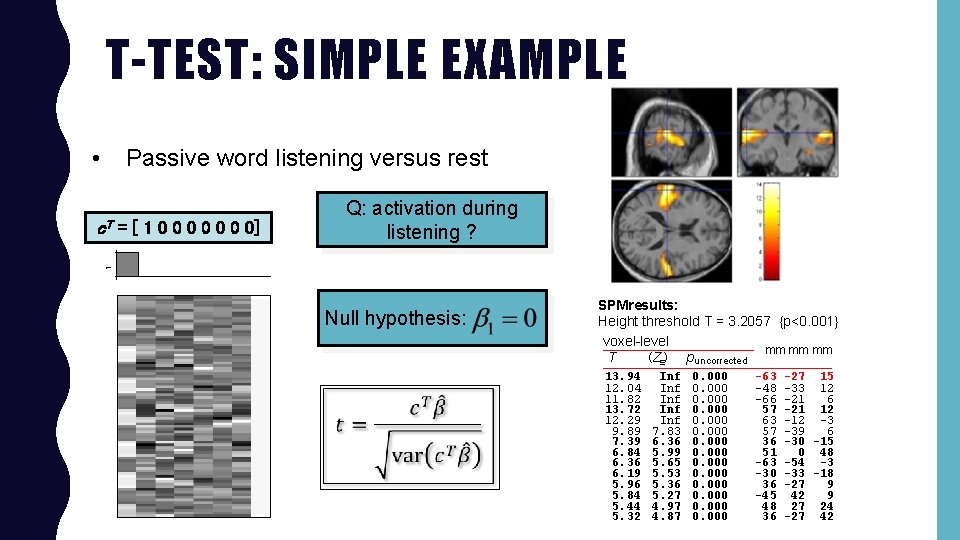 T-TEST: SIMPLE EXAMPLE • Passive word listening versus rest Q: activation during listening ?