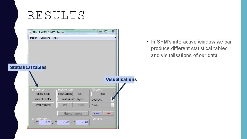 RESULTS • In SPM’s interactive window we can produce different statistical tables and visualisations