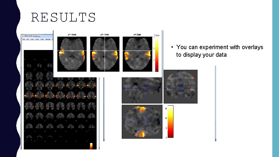 RESULTS • You can experiment with overlays to display your data 