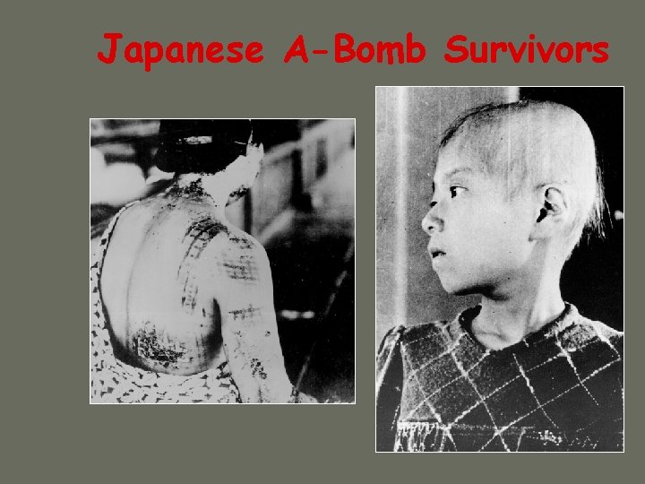 Japanese A-Bomb Survivors 