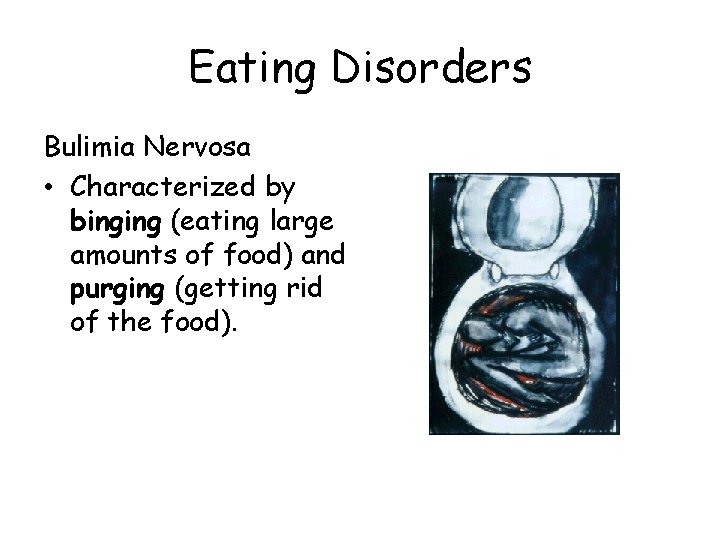 Eating Disorders Bulimia Nervosa • Characterized by binging (eating large amounts of food) and