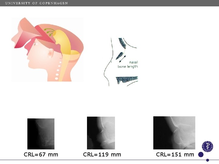 CRL=67 mm CRL=119 mm CRL=151 mm 