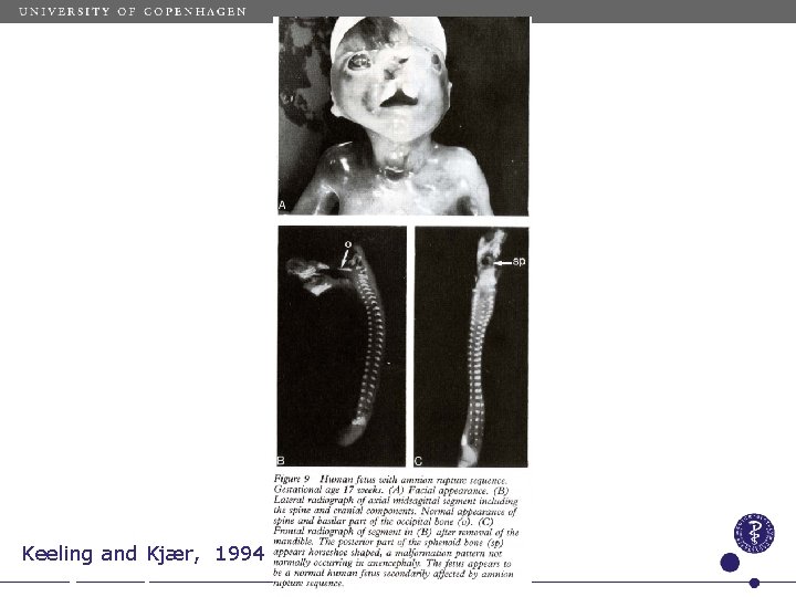 Keeling and Kjær, 1994 