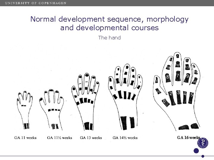 Normal development sequence, morphology and developmental courses The hand GA 16 weeks 
