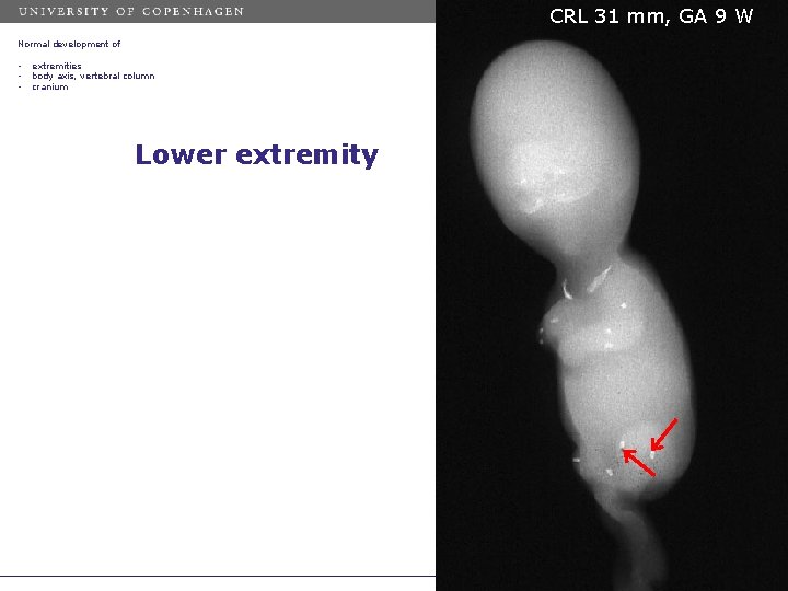 CRL 31 mm, GA 9 W Normal development of • • • extremities body