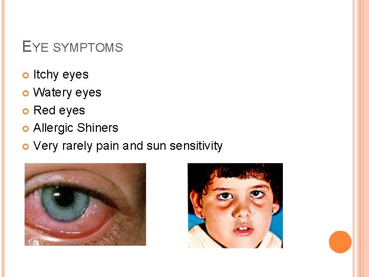 EYE SYMPTOMS Itchy eyes Watery eyes Red eyes Allergic Shiners Very rarely pain and