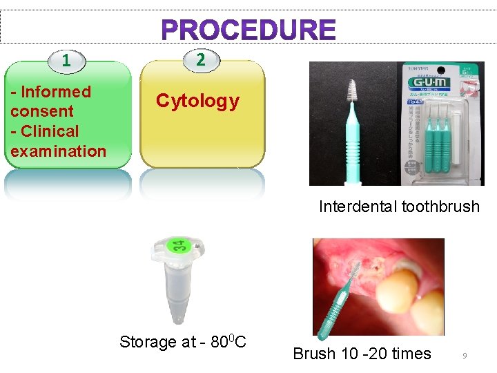 1 - Informed consent - Clinical examination 2 Cytology Interdental toothbrush Storage at -