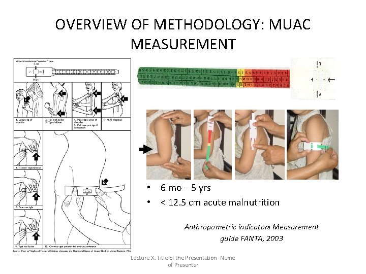 OVERVIEW OF METHODOLOGY: MUAC MEASUREMENT • 6 mo – 5 yrs • < 12. OVERVIEW OF METHODOLOGY: MUAC MEASUREMENT • 6 mo – 5 yrs • < 12.