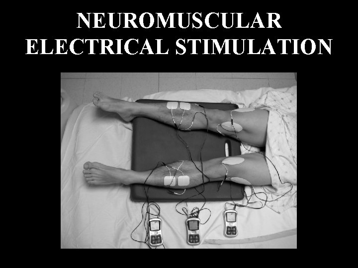 NEUROMUSCULAR ELECTRICAL STIMULATION 