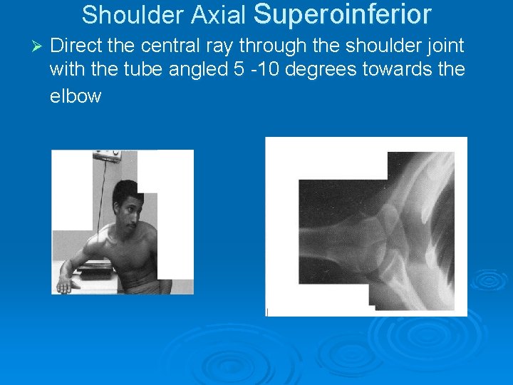 Shoulder Axial Superoinferior Ø Direct the central ray through the shoulder joint with the