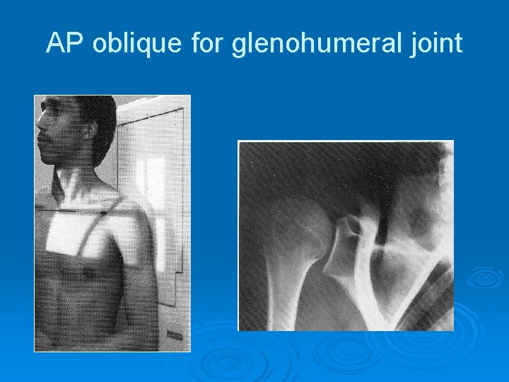 AP oblique for glenohumeral joint 