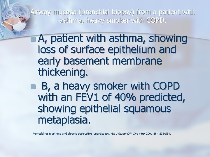 Airway mucosa (bronchial biopsy) from a patient with asthma, heavy smoker with COPD. n