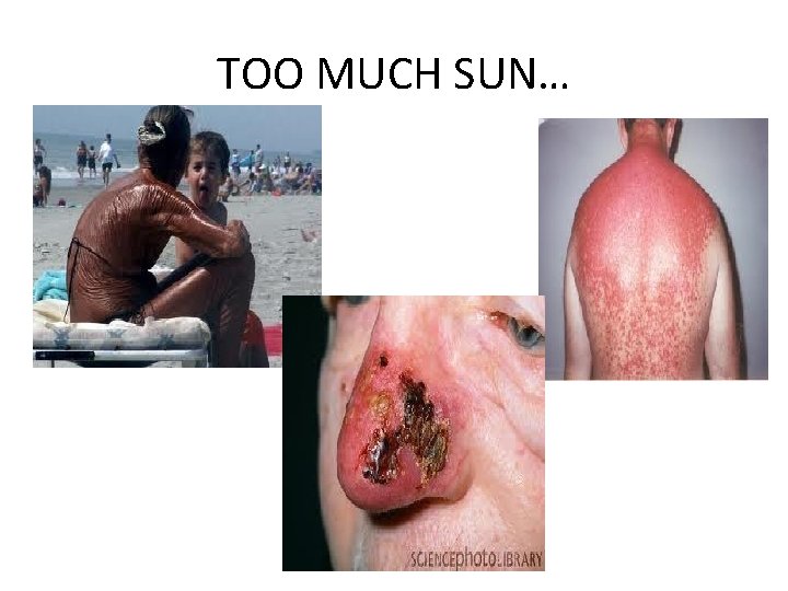 TOO MUCH SUN… 