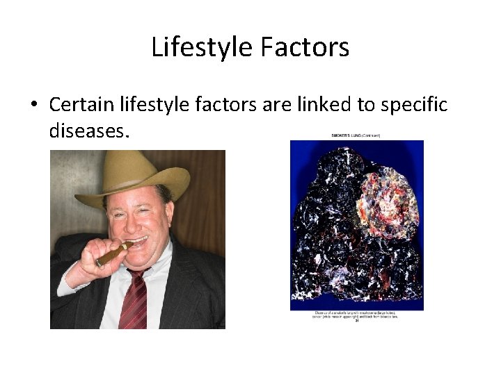 Lifestyle Factors • Certain lifestyle factors are linked to specific diseases. 